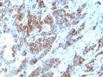 MUC1/CA15-3/EMA/CD227 (Epithelial Marker) Antibody in Immunohistochemistry (Paraffin) (IHC (P))