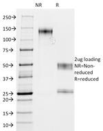 MUC1/CA15-3/EMA/CD227 (Epithelial Marker) Antibody in SDS-PAGE (SDS-PAGE)