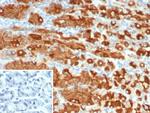 MUC1/CA15-3/EMA/CD227 (Epithelial Marker) Antibody in Immunohistochemistry (Paraffin) (IHC (P))