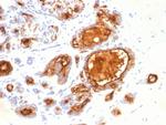 MUC1/CA15-3/EMA/CD227 (Epithelial Marker) Antibody in Immunohistochemistry (Paraffin) (IHC (P))