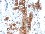 MUC1/CA15-3/EMA/CD227 (Epithelial Marker) Antibody in Immunohistochemistry (Paraffin) (IHC (P))