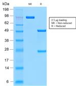 MUC1/CA15-3/EMA/CD227 (Epithelial Marker) Antibody in SDS-PAGE (SDS-PAGE)