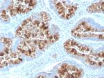 MUC1/CA15-3/EMA/CD227 Antibody in Immunohistochemistry (Paraffin) (IHC (P))