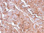 MUC1/CA15-3/EMA/CD227 Antibody in Immunohistochemistry (Paraffin) (IHC (P))