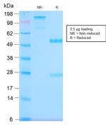 MUC1/CA15-3/EMA/CD227 Antibody in SDS-PAGE (SDS-PAGE)