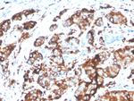 MUC1/CA15-3/EMA/CD227 (Epithelial Marker) Antibody in Immunohistochemistry (Paraffin) (IHC (P))