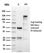 MUC1/CA15-3/EMA/CD227 (Epithelial Marker) Antibody in SDS-PAGE (SDS-PAGE)