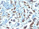 MUC3 (Mucin 3) Antibody in Immunohistochemistry (Paraffin) (IHC (P))