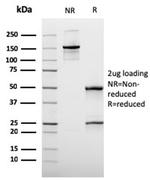 MUC3 (Mucin 3) Antibody in Immunohistochemistry (Paraffin) (IHC (P))