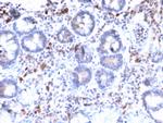 MUC3 (Mucin 3) Antibody in Immunohistochemistry (Paraffin) (IHC (P))