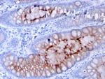 MUC4 (Mucin 4/Gastric Mucin) Antibody in Immunohistochemistry (Paraffin) (IHC (P))