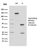 MUC4 (Mucin 4/Gastric Mucin) Antibody in SDS-PAGE (SDS-PAGE)