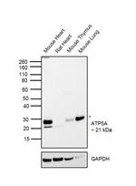 ATP5H Antibody