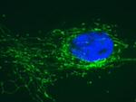 SDHB Antibody in Immunocytochemistry (ICC/IF)