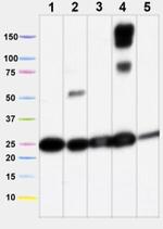 SDHB Antibody in Western Blot (WB)