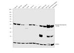 PDHA1 Antibody in Western Blot (WB)