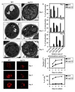 Porin Antibody in Immunocytochemistry (ICC/IF)