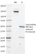 c-Myc Oncoprotein Antibody in SDS-PAGE (SDS-PAGE)