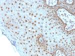 c-Myc Oncoprotein Antibody in Immunohistochemistry (Paraffin) (IHC (P))