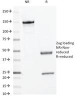 c-Myc Oncoprotein Antibody in SDS-PAGE (SDS-PAGE)