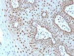 c-Myc Oncoprotein Antibody in Immunohistochemistry (Paraffin) (IHC (P))