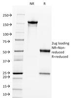 c-Myc Oncoprotein Antibody in SDS-PAGE (SDS-PAGE)