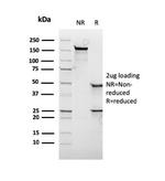 c-Myc Oncoprotein Antibody in SDS-PAGE (SDS-PAGE)