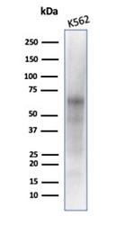 c-Myc Oncoprotein Antibody in Western Blot (WB)