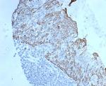 c-Myc Oncoprotein Antibody in Immunohistochemistry (Paraffin) (IHC (P))