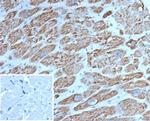 c-Myc Oncoprotein Antibody in Immunohistochemistry (Paraffin) (IHC (P))