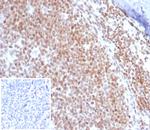 c-Myc Oncoprotein Antibody in Immunohistochemistry (Paraffin) (IHC (P))