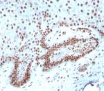 c-Myc Oncoprotein Antibody in Immunohistochemistry (Paraffin) (IHC (P))