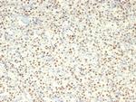 c-Myc Oncoprotein Antibody in Immunohistochemistry (Paraffin) (IHC (P))