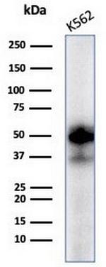 c-Myc Oncoprotein Antibody in Western Blot (WB)