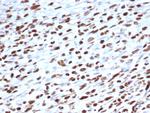 MyoD1 (Rhabdomyosarcoma Marker) Antibody in Immunohistochemistry (Paraffin) (IHC (P))