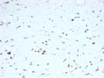 MyoD1 Antibody in Immunohistochemistry (Paraffin) (IHC (P))