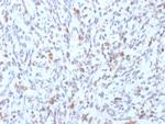 MyoD1 Antibody in Immunohistochemistry (Paraffin) (IHC (P))