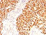 Myogenin/Myf-4 (Skeletal Muscle Marker) Antibody in Immunohistochemistry (Paraffin) (IHC (P))