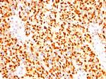 Myogenin/Myf-4 (Skeletal Muscle Marker) Antibody in Immunohistochemistry (Paraffin) (IHC (P))