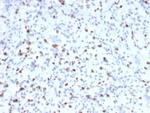 Myogenin/Myf-4 (Skeletal Muscle Marker) Antibody in Immunohistochemistry (Paraffin) (IHC (P))