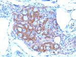 CD56/NCAM1 (Neuronal Cell Marker) Antibody in Immunohistochemistry (Paraffin) (IHC (P))