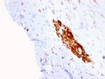 CD56/NCAM1/NKH1 (Neuronal Cell Marker) Antibody in Immunohistochemistry (Paraffin) (IHC (P))