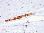 CD56/NCAM1/NKH1 (Neuronal Cell Marker) Antibody in Immunohistochemistry (Paraffin) (IHC (P))