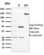 CD56/NCAM1/NKH1 (Neuronal Cell Marker) Antibody in SDS-PAGE (SDS-PAGE)