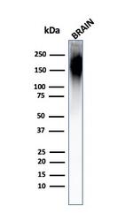 Neurofilament (NF-H) (Neuronal Marker) Antibody in Western Blot (WB)