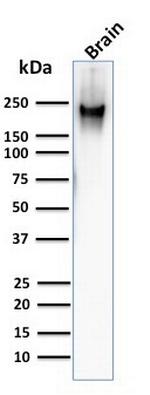 Neurofilament (NF-H) (Neuronal Marker) Antibody in Western Blot (WB)