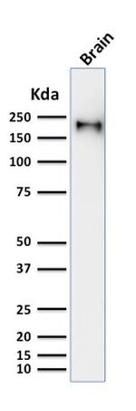 Neurofilament Antibody in Western Blot (WB)