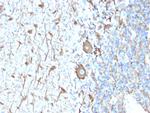 Neurofilament Antibody in Immunohistochemistry (Paraffin) (IHC (P))