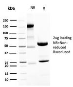 Neurofilament Antibody in SDS-PAGE (SDS-PAGE)