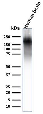 Neurofilament Antibody in Western Blot (WB)